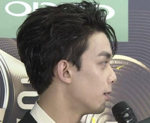 凸嘴明星,揭秘明星们的独特风采